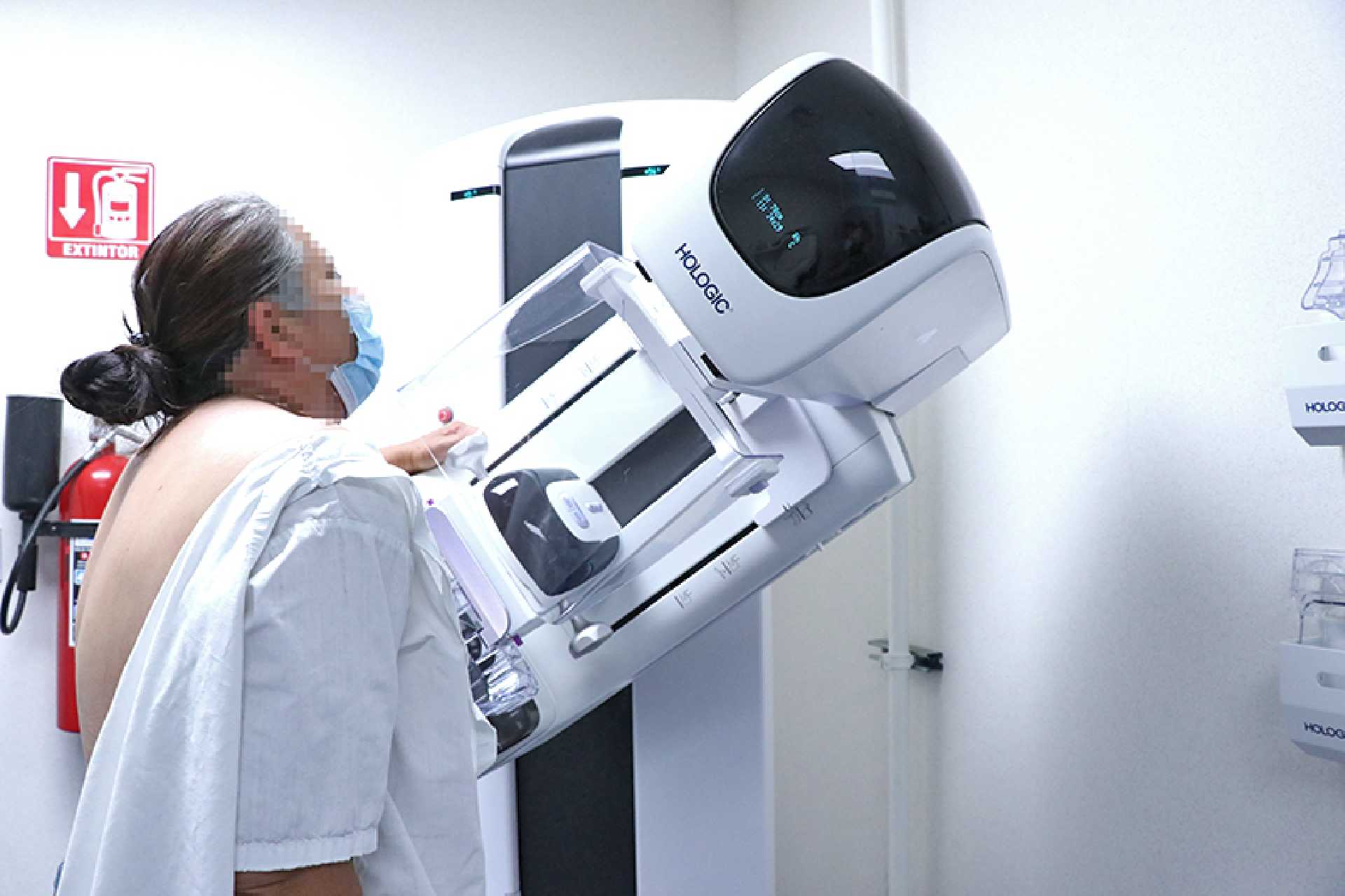 TIENE CENTRO ESTATAL DE ONCOLOGÍA HORARIO VESPERTINO PARA LA REALIZACIÓN DE LA MASTOGRAFÍA